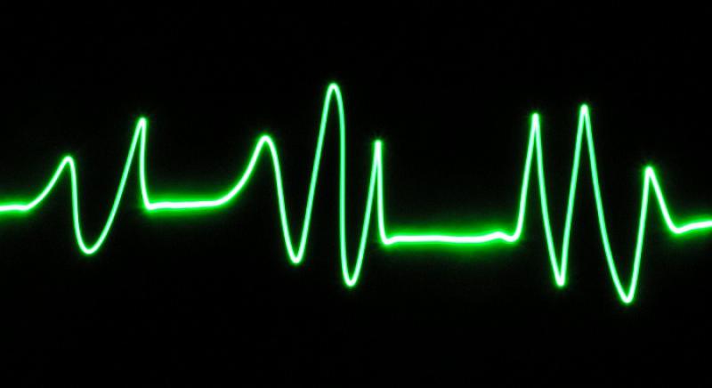 Klijenti kanadske banke plaćat će račune pomoću svojih otkucaja srca