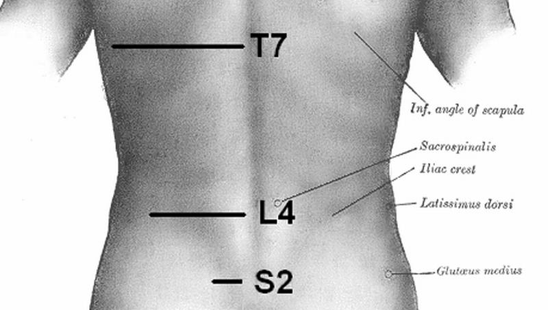 Bole vas leđa? Ovo su četiri moguća razloga