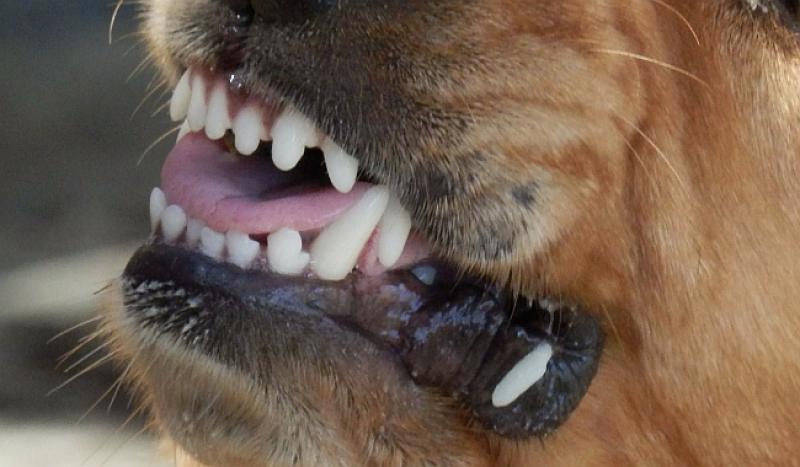 DOKTORI JOJ SPAŠAVALI RUKE: Hrvaticu u Irskoj umalo ubio njen pas