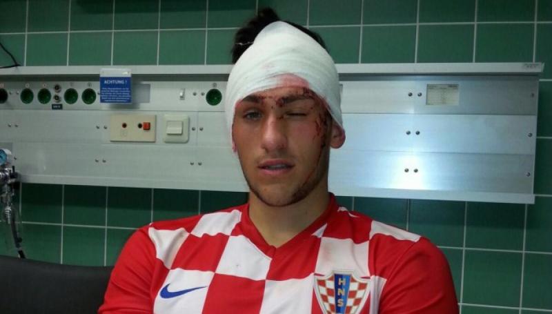 BRZ OPORAVAK ŽELIMO Igrač hrvatskog kluba u Njemačkoj teško ozlijeđen