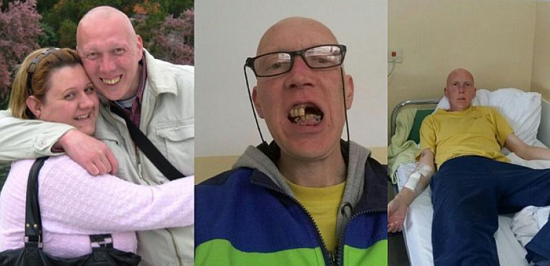 STANJE MU SE POGORŠALO Zbog Chronove bolesti Siniši Želaliji je potrebna naša pomoć