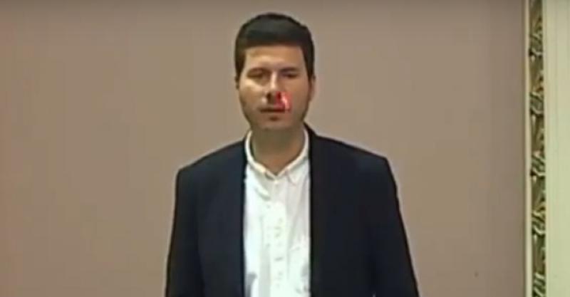 (VIDEO) DJEČJA POSLA Pernaru u Saboru svijetlili laserom u oči: 'Je li to normalno?'