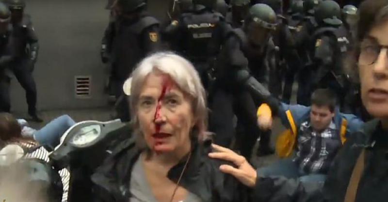 NASILJE U KATALONIJI Više stotina ljudi ozlijeđeno, policija tukla i pucala