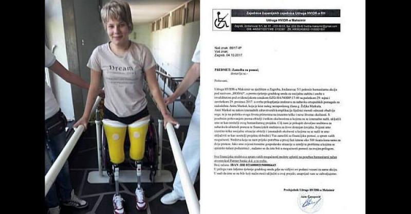 ANITA (16) NEMA OBJE POTKOLJENICE Postoji nada da će moći normalnije živjeti, ali treba našu pomoć