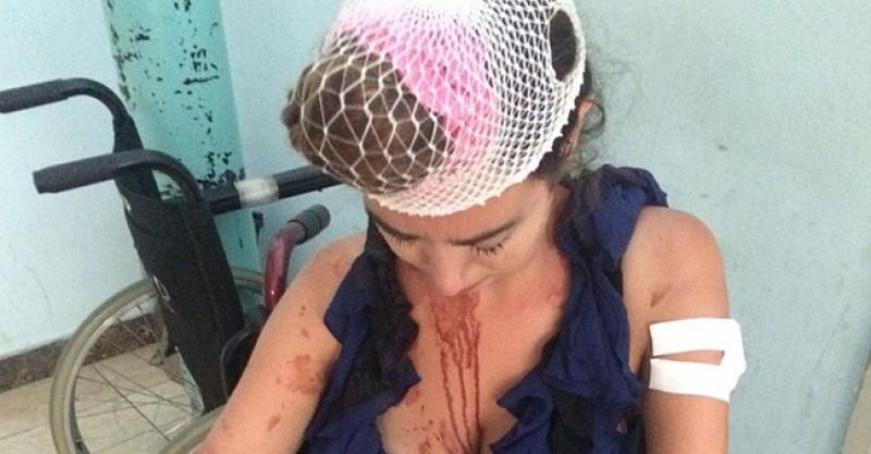 PRETUČENA BRITANKA ZAHVALILA NA PONUDI TURISTIČKE ZAJEDNICE SPLITA 'Dobrih i loših ljudi ima svugdje'