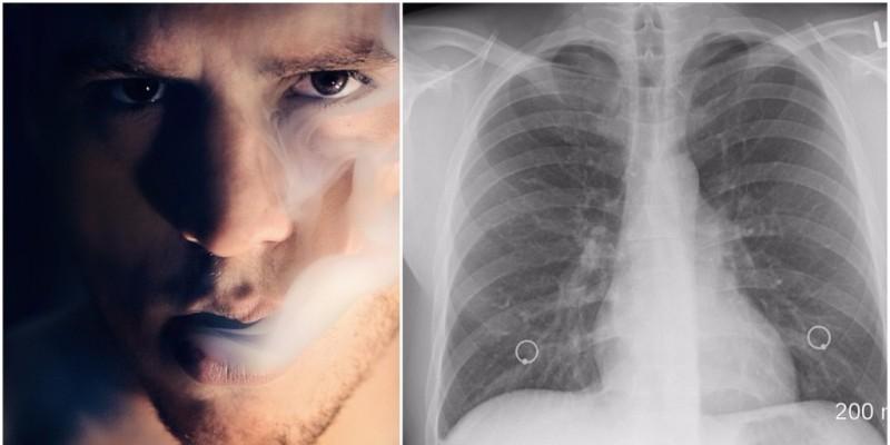 EVO JOŠ JEDNOG RAZLOGA DA ODMAH PRESTANETE DIMITI Već nakon 24 sata, rizik od srčanog udara se smanjuje, kao i krvni pritisak!