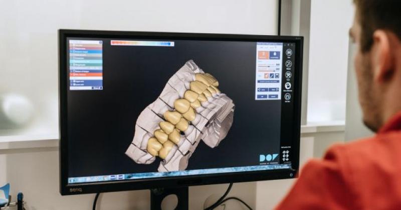 (VIDEO) Zavirite u high-tech dentalni centar budućnosti: Brže i udobnije do novih zubi!