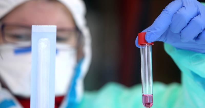 STANJE U HRVATSKOJ, 5. TRAVNJA - Ukupno umrlo 15 zaraženih; na respiratoru trenutno 39 bolesnika