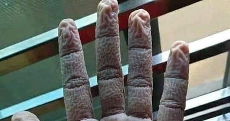 ZNATE LI ZAŠTO JE FOTOGRAFIJA OVE SMEŽURANE RUKE TAKO POSEBNA? Zaradila je tisuće i tisuće lajkova