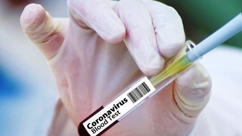 SAD odobrio cjepivo, spreman za masovno cijepljenje